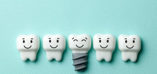 Co warto wiedzieć przed wyborem implantów dentystycznych?